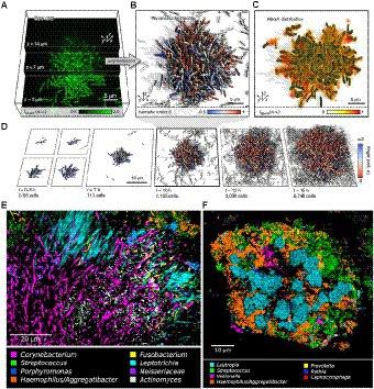 pH variation in medical implant biofilms: Causes, measurements, and its implications for antibiotic resistance